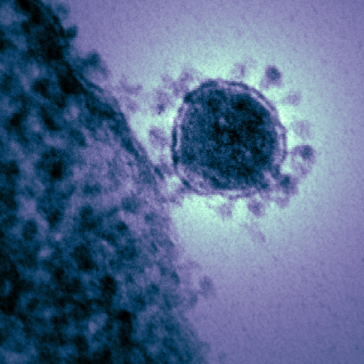 Previously Known Strains Of Coronavirus